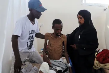 Katil İsrail hem kurşunla hem açlıkla vuruyor: Gazzeli Ebu Camus yaşam savaşı veriyor
