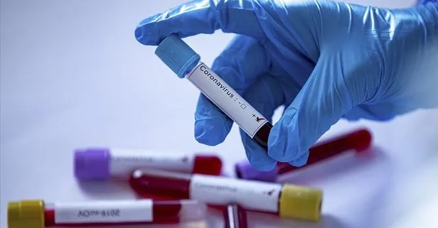 Dünya Sağlık Örgütü DSÖ Filistin’e koronavirüs teşhis kiti gönderecek