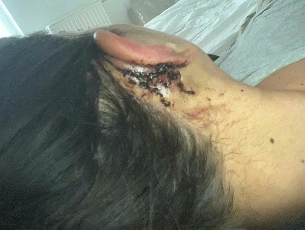 Son dakika: Ünlü estetisyen Op. Dr. Bilgehan Aydın'dan skandal olay! Burun operasyonu için kulağını kesti: Psikolojisi bozuldu-4