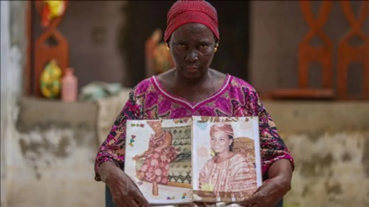 Afrika’da milyonlarca kadın cilt beyazlatma ürünleri nedeniyle sağlık riskiyle karşı karşıya