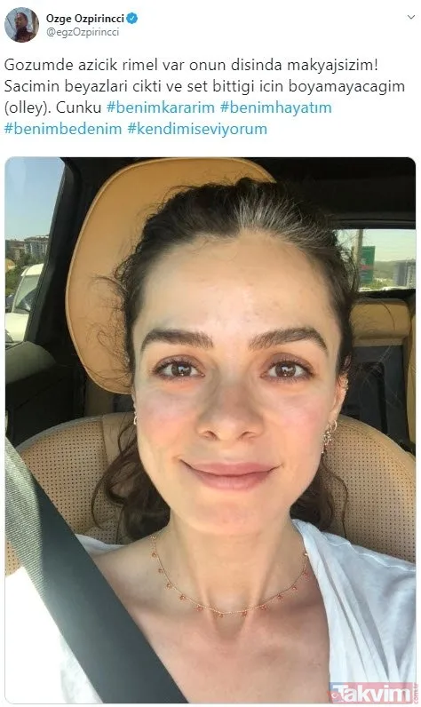 'Hehe' diyerek paylaştı son pozunu gören gözlerine inanamadı! Yıldız Tilbe'nin dişine ne oldu? 57 yaşındaki Yıldız Tilbe... - 44