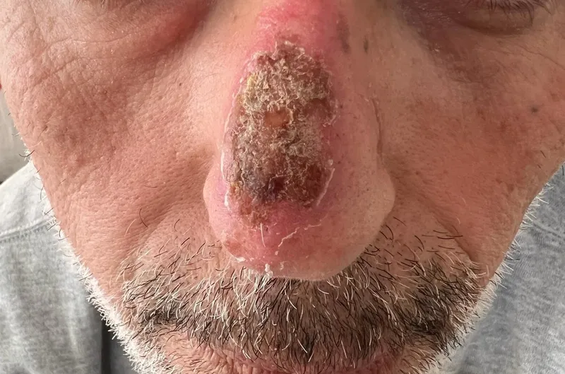 soykirimci-israil-vahsete-doymuyor-el-emel-hastanesinde-alikoydugu-2-doktora-uyguladigi-iskencenin-fotograflar-1708186232341.jpeg Soykırımcı İsrail vahşete doymuyor! El-Emel Hastanesinde alıkoyduğu 2 doktora uyguladığı işkencenin fotoğrafları ortaya çıktı-4