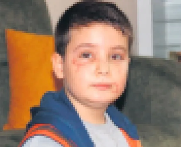 Sokak köpekleri saldırısının adresi bu kez Manisa! 8 yaşındaki çocuğa 60 dikiş atıldı-1