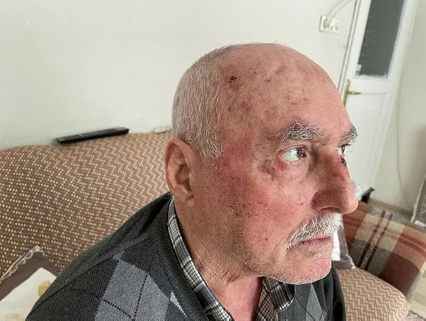 75-yasindaki-yolcuyu-darbeden-iett-soforu-tutuklandi-1649775086637.jpeg 75 yaşındaki yolcuyu darbeden İETT şoförü tutuklandı!-5