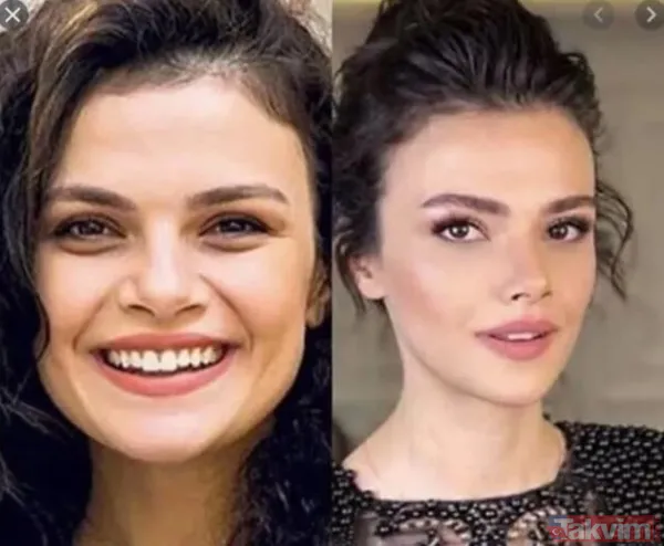 Sinem Ünsal'ı estetiksiz haliyle görenler şaştı! Estetikli mi estetiksiz mi? - 17