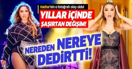 hadise estetiksiz hali haberleri son dakika hadise estetiksiz hali gelismeleri