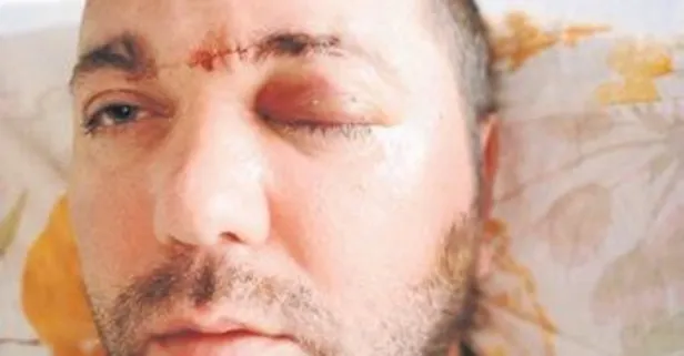 Sıra’dişi’ skandal