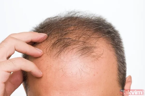 Kelliğin merhemi bulundu hem de mutfağınızda! Çare yine evden çıktı ama 40 yıl düşünsek aklımıza gelmez meğer... - 7