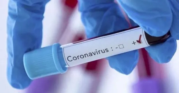 Vaka sayısı artıyor... Türkiye’de corona virüsü (Kovid-19) hangi illerde var?-2