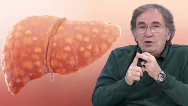 İbrahim Saraçoğlundan zehri, yağı, toksinleri kapı dışarı edecek tarif: Karaciğeri baştan aşağı temizleyen, arındıran mucize kür!