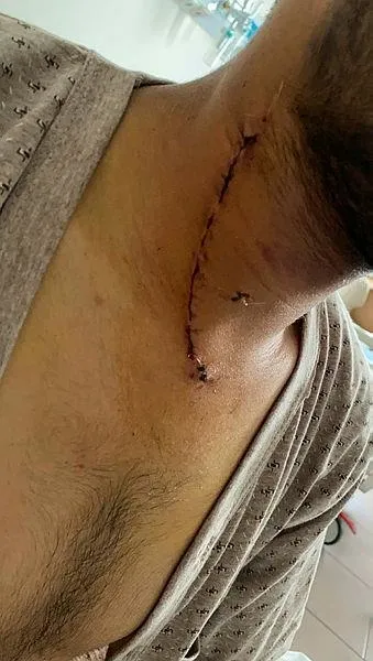 Ankara'da taş ocağında parçaladığı taş boğazını kesti! Genç adam direndi hayata tutundu-2