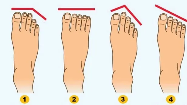 Ayak şekli böyle olanlar doğuştan lider! Şans eninde sonunda onları buluyor! Eğer baş parmağınız...