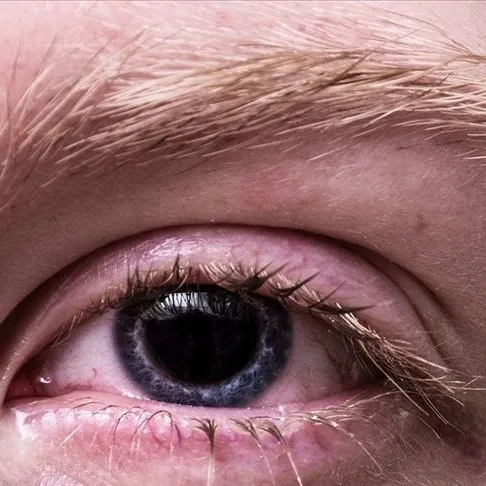 Bu belirtileri yaşıyorsanız dikkat