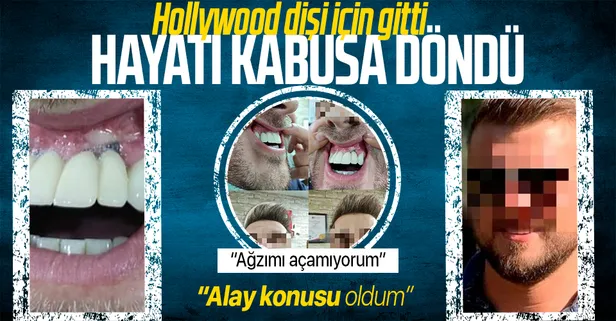 'Hollywood dişi yapalım' dediler! Hayatı kabusa döndü: Alay konusu oldum ağzımı açamıyorum