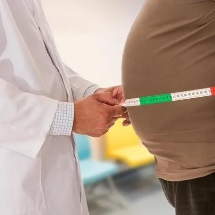 4 kişiden 1’i obez