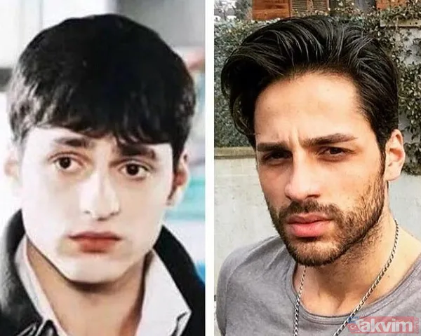 47 kiloya düşen Tanyeli'nin son hali şoke etti! Pankreas kanseriyle mücadele ediyor! "10 gün sonra evden ilk defa çıkabildim..." - 47