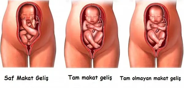 ters-dogum-nedir-dogum-kocu-evde-dogum-yaptirdi-ters-gelen-bebek-oksijensizlikten-oldu-1641992779917.jpg Ters doğum nedir? Doğum koçu evde doğum yaptırdı! Ters gelen bebek oksijensizlikten öldü-6