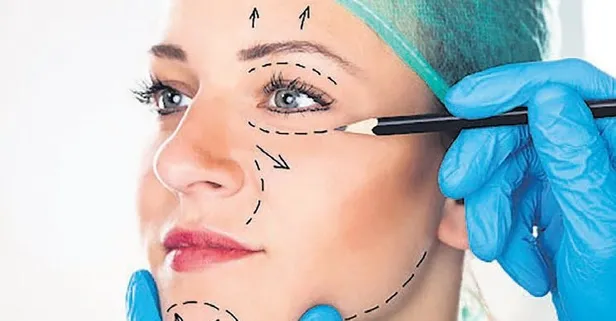 Estetik boşanma sebebi (Yurttan ve dünyadan haberler)