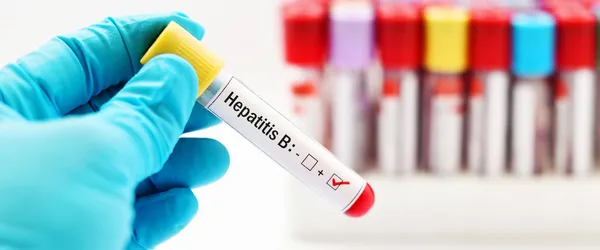 hepatit-testi-pozitif-ciktigi-icin-avukat-sevgilisinden-dayak-yiyen-kadin-sikayetci-oldu-1621921673955.jpg Hepatit testi pozitif çıktığı için avukat sevgilisinden dayak yiyen kadın şikayetçi oldu-2