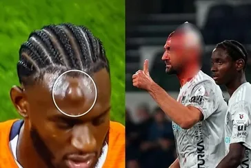 Başakşehir - Kocaelispor maçında talihsiz an!