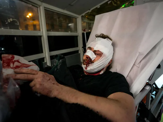 Fransa'da polisin orantısız müdahalesini Batı görmüyor! Genç gazeteci öldüresiye dövüldü-1