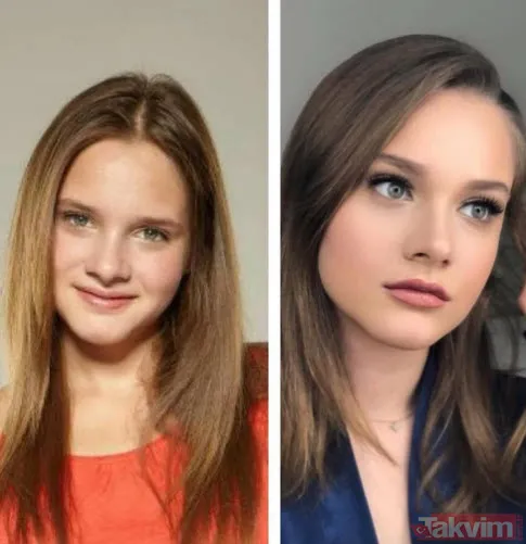 Aleyna Tilki hastanelik oldu paylaşımıyla korkuttu! Sette yürüyemez hale gelen Aleyna Tilki'ye ne oldu? - 24