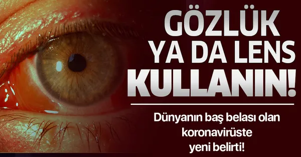 Gözlere dikkat! Koronavirüsün yeni belirtisi ortaya çıktı! Koronavirüs belirtileri nelerdir?-1