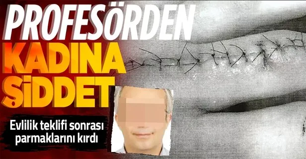 Ankara’da beyin cerrahı profesörden kadın doktora şiddet