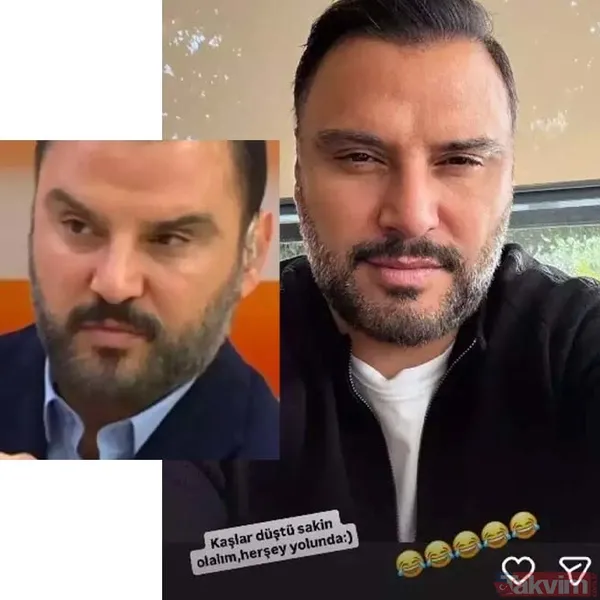 Alişan'dan botoks itirafı! İşte estetik yaptıran erkek ünlüler - 2
