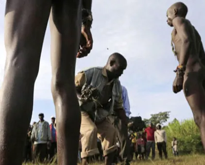 Böyle sünnet görülmedi! Ne iğne ne alkol...