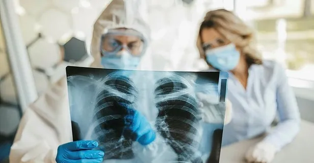 Koronavirüs geçiren kadınlar 4 ay, erkekler 5 ay halsizlik ve nefes darlığı çekiyor!