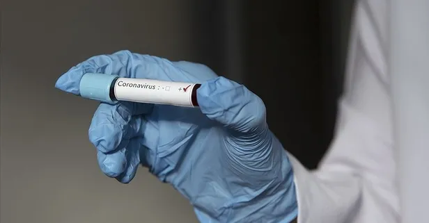 Son dakika: Koronavirüs salgını için müjdeli haber! İlaç için tarih verildi