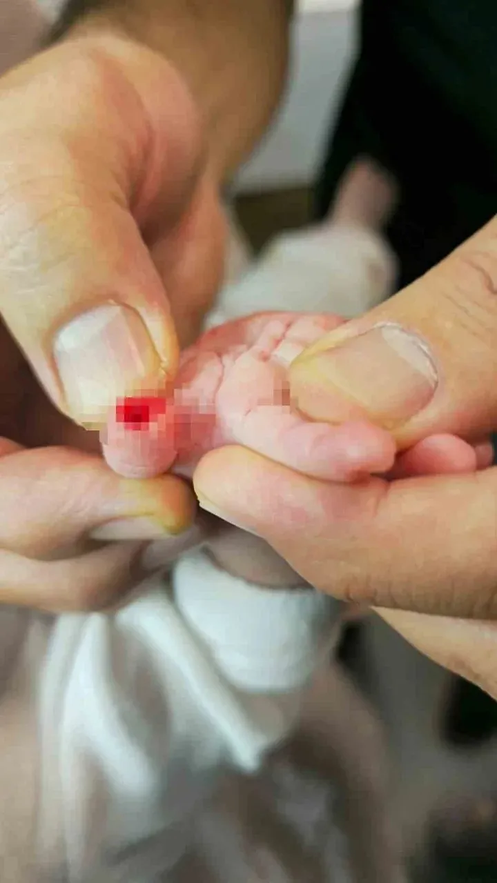Serum bandajını çıkarırken dehşeti yaşattı: 5 aylık bebeğin parmağı koptu-5