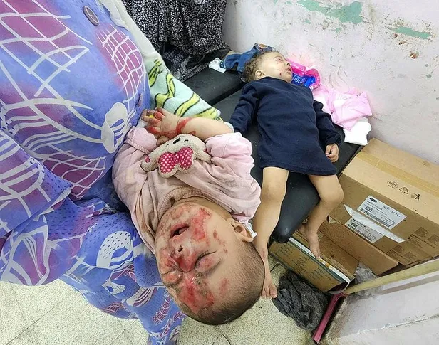 gazzede-icler-acisi-durum-tedavi-olmadigi-icin-siviller-olume-terk-edildi-defnedilemeyenlerin-bir-kismini-ise-1699822044208.jpeg Gazze'de içler acısı durum | Tedavi olmadığı için siviller ölüme terk edildi! Defnedilemeyenlerin bir kısmını ise köpekler parçaladı-3