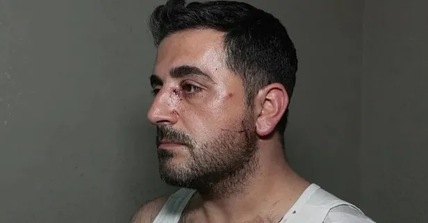 Esenyurt’ta kiracı dehşeti: Ev sahibini bıçakladı ölümden döndü!