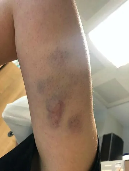 Artvin'de koronalı hastanın saldırısına maruz kalan doktoru bu kez ağabeyi darp etti-1