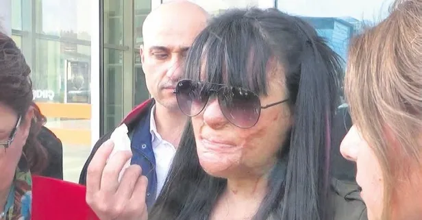 Berfin Özek davasında savcı Öldürme kastı yok deyip saldırgan için 1 yıl hapis istemiyle mütalaa hazırladı